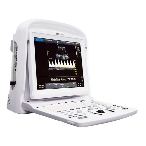Chison ECO 3 Expert