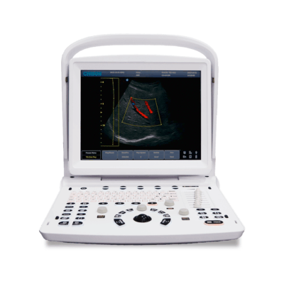 Eco3_Pro Chison ECO3