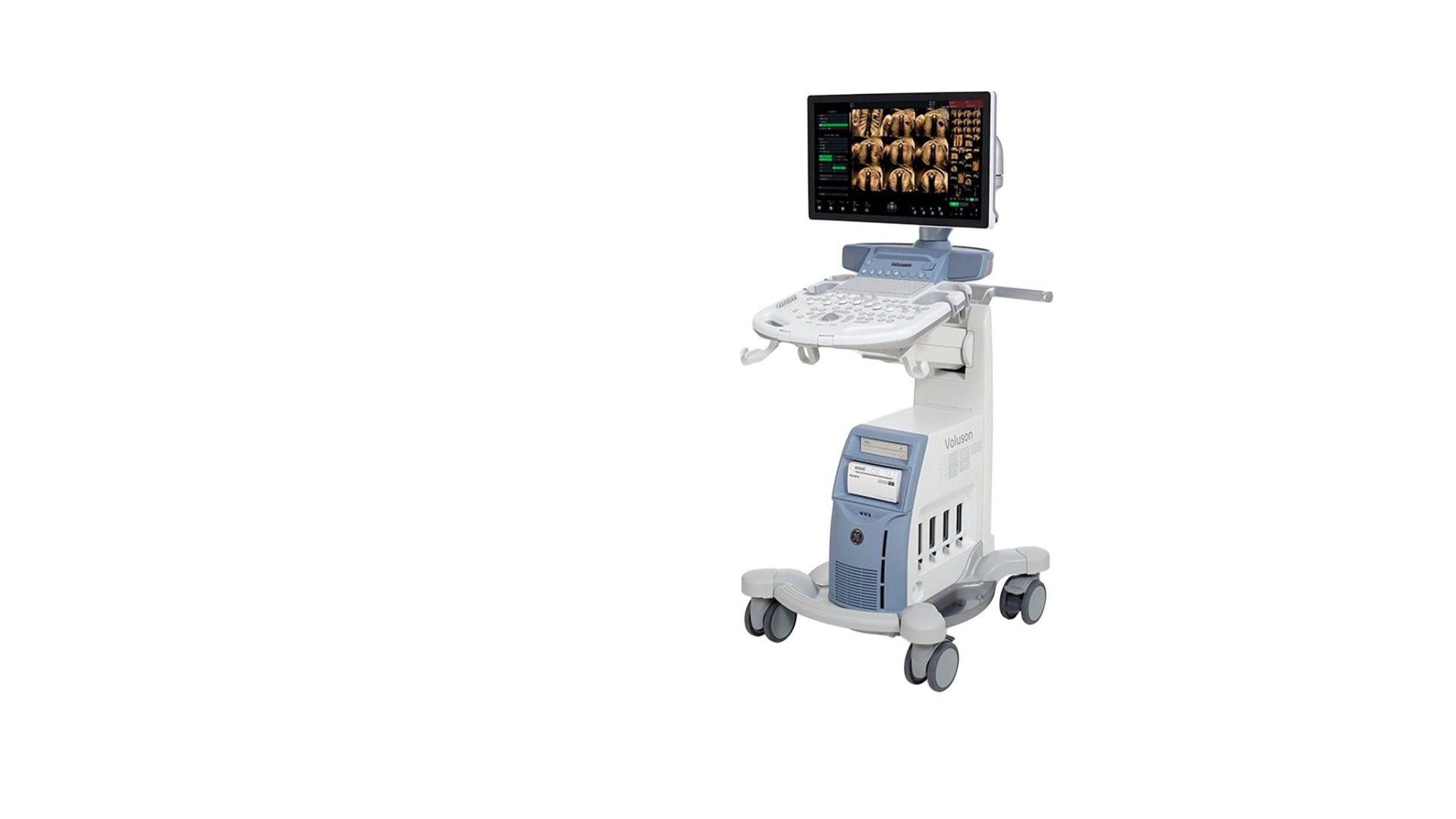 Voluson S10